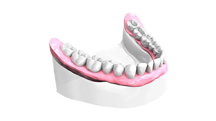 Remplacer une dent - Cabinet dentaire du Dr Ludovic Ache Paris 16