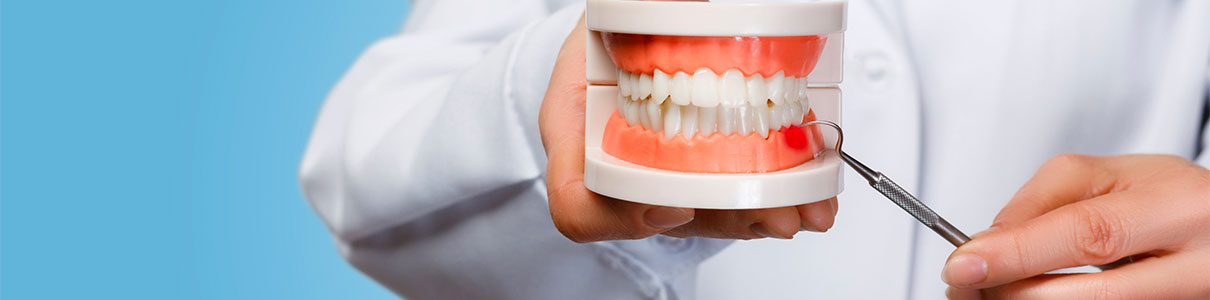 Parodontologie - Cabinet dentaire du Dr Ludovic Ache Paris 16